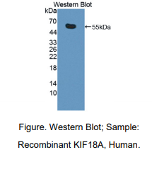 人驱动蛋白家族成员18A(KIF18A)多克隆抗体