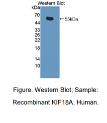 https://msimg.bioon.com/bionline/goods-no-pic.png