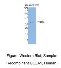 https://msimg.bioon.com/bionline/goods-no-pic.png