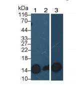 https://msimg.bioon.com/bionline/goods-no-pic.png