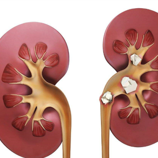 https://msimg.bioon.com/bionline/goods-no-pic.png
