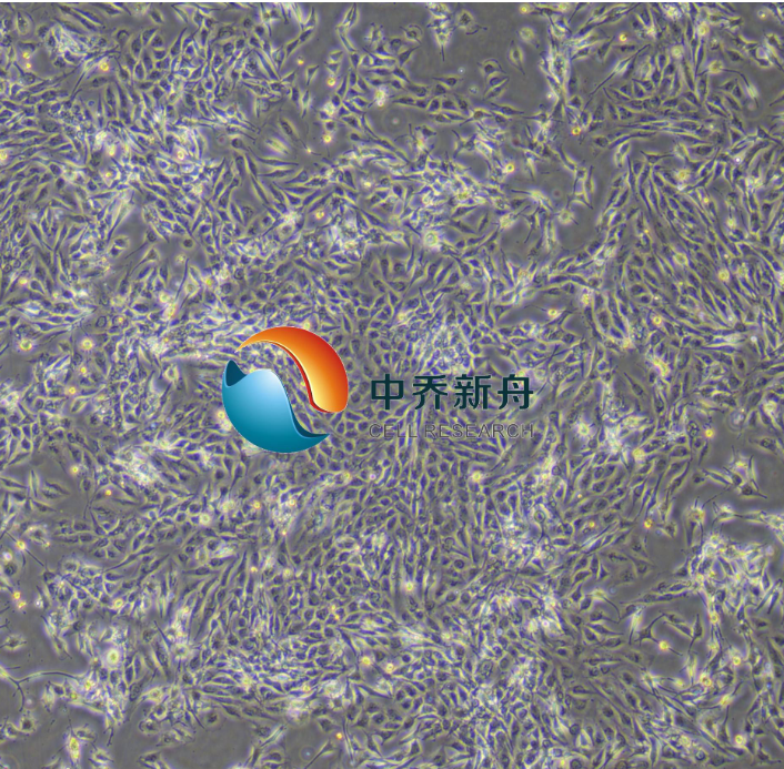 人脑星形胶质细胞瘤细胞