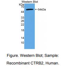 人糜蛋白酶原B2(CTRB2)多克隆抗体