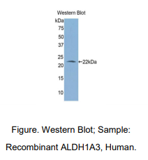 https://msimg.bioon.com/bionline/goods-no-pic.png