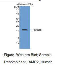 人溶酶体关联膜蛋白2(LAMP2)多克隆抗体