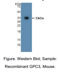 https://msimg.bioon.com/bionline/goods-no-pic.png