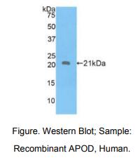 https://msimg.bioon.com/bionline/goods-no-pic.png