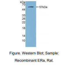 https://msimg.bioon.com/bionline/goods-no-pic.png