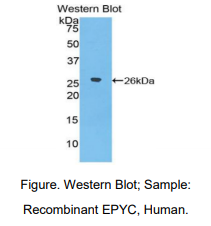 https://msimg.bioon.com/bionline/goods-no-pic.png