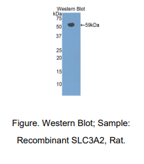 https://msimg.bioon.com/bionline/goods-no-pic.png