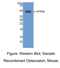 https://msimg.bioon.com/bionline/goods-no-pic.png