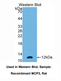 https://msimg.bioon.com/bionline/goods-no-pic.png