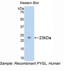 人糖原磷酸化酶L(PYGL)多克隆抗体
