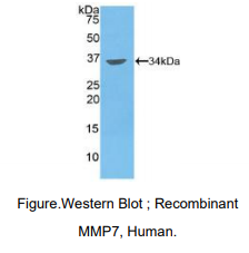 人基质金属蛋白酶7(MMP7)多克隆抗体