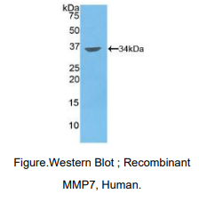 https://msimg.bioon.com/bionline/goods-no-pic.png