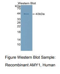 人唾液淀粉酶α1(AMY1A)多克隆抗体