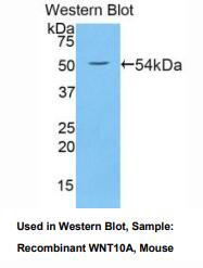 https://msimg.bioon.com/bionline/goods-no-pic.png