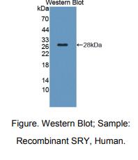 人性别决定区Y(SRY)多克隆抗体