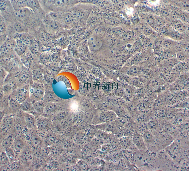 人整合SV40基因的乳腺上皮细胞