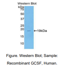 人粒细胞集落刺激因子(GCSF)多克隆抗体