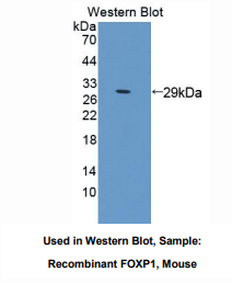 https://msimg.bioon.com/bionline/goods-no-pic.png