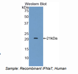 人干扰素α7(IFNa7)多克隆抗体