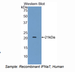 https://msimg.bioon.com/bionline/goods-no-pic.png