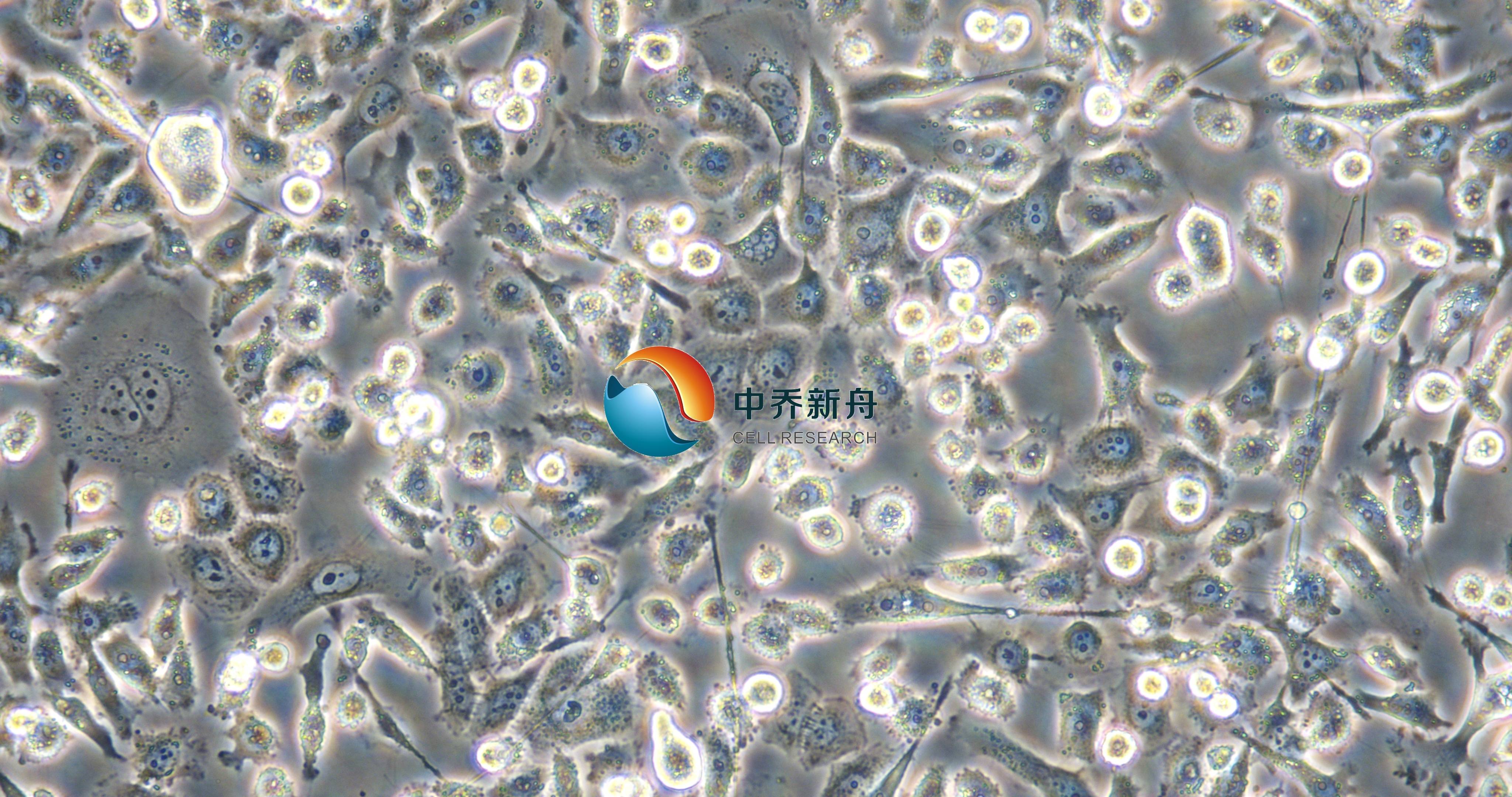 PC-3-GFP+LUC 人前列腺癌细胞-绿色+荧光素酶标记