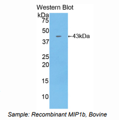 牛巨噬细胞炎性蛋白1β(MIP1b)多克隆抗体