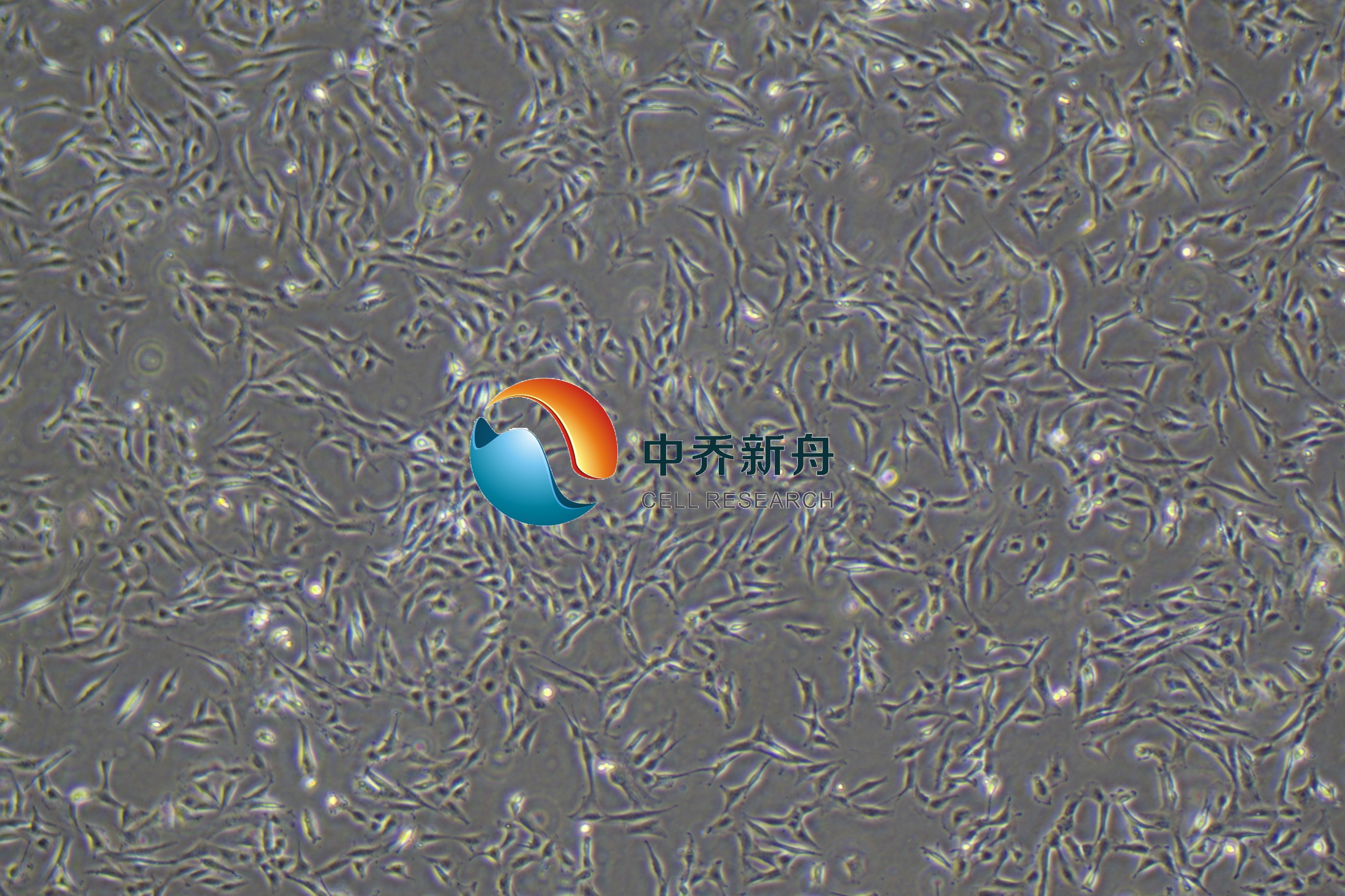 人髓核细胞永生化