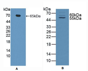 https://msimg.bioon.com/bionline/goods-no-pic.png