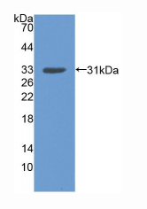 人盘状结构域受体家族成员2(DDR2)多克隆抗体