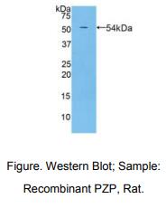 https://msimg.bioon.com/bionline/goods-no-pic.png