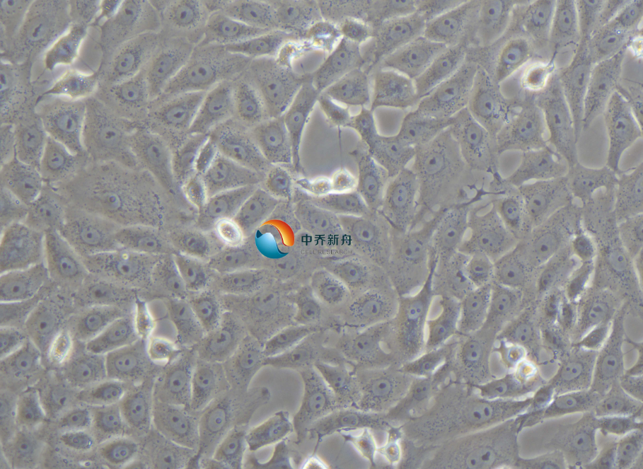 https://img.medsci.cn/8eee53bbc4cb7a98de615e72115896bc4e27fda5cbb764dbd67d9d641c2bb46a.png