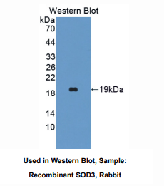 https://msimg.bioon.com/bionline/goods-no-pic.png