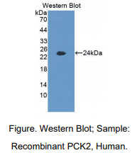 人磷酸烯醇式丙酮酸羧激酶2(PCK2)多克隆抗体