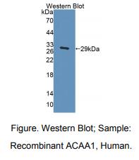 小鼠乙酰辅酶A酰基转移酶1(ACAA1)多克隆抗体