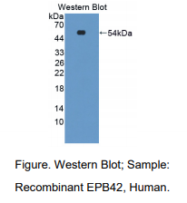 人红细胞膜蛋白带4.2(EPB42)多克隆抗体