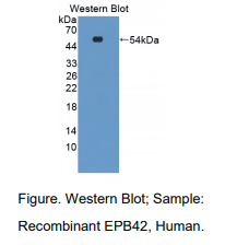 https://msimg.bioon.com/bionline/goods-no-pic.png