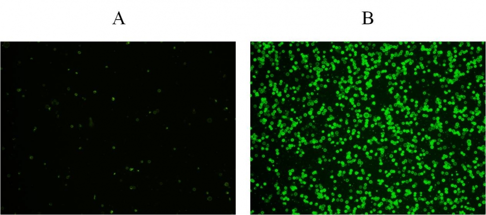 https://img.medsci.cn/e73eefcea40976357f460123cbf1e819c54e5106c9b457225be13b1cbc991aff.png