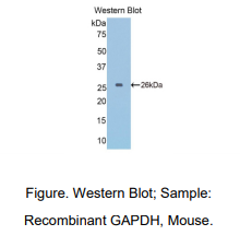 https://msimg.bioon.com/bionline/goods-no-pic.png