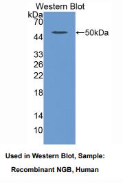 人脑红蛋白(NGB)多克隆抗体