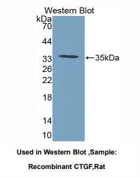 https://msimg.bioon.com/bionline/goods-no-pic.png