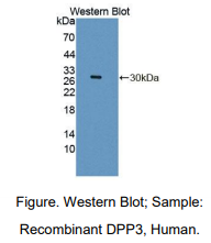 https://msimg.bioon.com/bionline/goods-no-pic.png