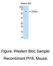 https://msimg.bioon.com/bionline/goods-no-pic.png