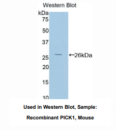 https://msimg.bioon.com/bionline/goods-no-pic.png