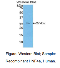 人肝细胞核因子4α(HNF4a)多克隆抗体