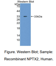 https://msimg.bioon.com/bionline/goods-no-pic.png