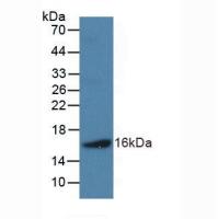 人钠尿肽前体B(NPPB)多克隆抗体