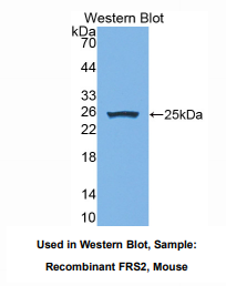 https://msimg.bioon.com/bionline/goods-no-pic.png